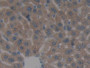 DAB staining on IHC-P; Samples: Mouse Liver Tissue;  Primary Ab: 10µg/ml Rabbit Anti-Mouse PST Antib