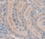 Androgen Receptor (Ar) Polyclonal Antibody, Cat#CAU26260