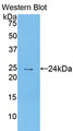 Western Blot; Sample: Recombinant protein.