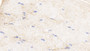 DAB staining on IHC-P; Samples: Bovine Skeletal muscle Tissue; Primary Ab: 20μg/ml Rabbit Anti-Bovine FABP3 Antibody Second Ab: 2µg/mL HRP-Linked Caprine Anti-Rabbit IgG Polyclonal Antibody