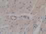 DAB staining on IHC-P; Samples: Mouse Heart Tissue; Primary Ab: 10µg/ml Rabbit Anti-Mouse ABCA1 Antibody Second Ab: 2µg/mL HRP-Linked Caprine Anti-Rabbit IgG Polyclonal Antibody