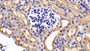 DAB staining on fromalin fixed paraffin- embedded intestine tissue)
