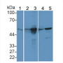 Western Blot; Sample: Lane1: Mouse Serum; Lane2: Mouse Stomach lysate; Lane3: Mouse Small intestine lysate; Lane4: Mouse Mastadenoma; Lane5: Hela cell lysate; Primary Ab: 3µg/ml Rabbit Anti-Mouse KRT20 Antibody; Second Ab: 0.2µg/mL HRP-Linked Caprine Anti-Rabbit IgG Polyclonal Antibody;