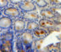 DAB staining on fromalin fixed paraffin-embedded bowels tissue)