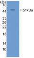 Western Blot; Sample: Recombinant KRT20, Human.