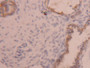 DAB staining on IHC-P; Samples: Rat Ovary Tissue)