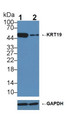 Knockout Varification: &lt;br/&gt;Lane 1: Wild-type HepG2 cell lysate; &lt;br/&gt;Lane 2: KRT19 knockout HepG2 cell lysate; &lt;br/&gt;Predicted MW: 44kDa &lt;br/&gt;Observed MW: 50kDa&lt;br/&gt;Primary Ab: 2µg/ml Rabbit Anti-Human KRT19 Antibody&lt;br/&gt;Second Ab: 0.2µg/mL HRP-Linked Caprine Anti-Rabbit IgG Polyclonal Antibody&lt;br/&gt;