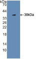 Western Blot; Sample: Recombinant Plg, Human.