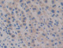 DAB staining on IHC-P; Samples: Human Liver Tissue.