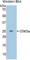 Western Blot; Sample: Recombinant protein.