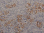 DAB staining on fromalin fixed paraffin-embedded Kidney tissue)