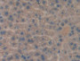 DAB staining on fromalin fixed paraffin- embedded Kidney tissue)