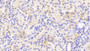DAB staining on IHC-P; Samples: Human Kidney Tissue;  Primary Ab: 20μg/ml Rabbit Anti-Human ITGa2 Antibody Second Ab: 2µg/mL HRP-Linked Caprine Anti-Rabbit IgG Polyclonal Antibody 