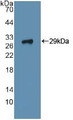 Western Blot; Sample: Recombinant ITGa2, Human.