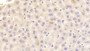 DAB staining on IHC-P; Samples: Rat Liver Tissue; Primary Ab: 20μg/ml Rabbit Anti-Rat CBG Antibody Second Ab: 2µg/mL HRP-Linked Caprine Anti-Rabbit IgG Polyclonal Antibody