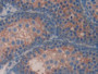 DAB staining on IHC-P; Samples: Mouse Testis Tissue; Primary Ab: 30µg/ml Rabbit Anti-Mouse CBG Antibody Second Ab: 2µg/mL HRP-Linked Caprine Anti-Rabbit IgG Polyclonal Antibody