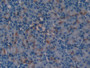 DAB staining on IHC-P; Samples: Mouse Kidney Tissue;  Primary Ab: 10µg/ml Rabbit Anti-Mouse CBG Anti