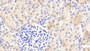 DAB staining on IHC-P; Samples: Human Kidney Tissue; Primary Ab: 20μg/ml Rabbit Anti-Human CBG Antibody Second Ab: 2µg/mL HRP-Linked Caprine Anti-Rabbit IgG Polyclonal Antibody