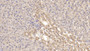 DAB staining on IHC-P; Samples: Human Liver Tissue;  Primary Ab: 20µg/ml Rabbit Anti-Human CBG Antibody Second Ab: 2µg/mL HRP-Linked Caprine Anti-Rabbit IgG Polyclonal Antibody 