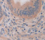 Relaxin (Rln) Polyclonal Antibody, Cat#CAU26344