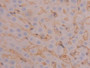 DAB staining on IHC-P; Samples: Rat Liver Tissue; Primary Ab: 20µg/ml Rabbit Anti-Rat FGb Antibody Second Ab: 2µg/mL HRP-Linked Caprine Anti-Rabbit IgG Polyclonal Antibody