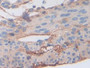 DAB staining on fromalin fixed paraffin-embedded Liver tissue)