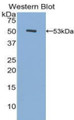 Western Blot; Sample: Recombinant FGa, Human.