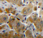 Used in DAB staining on fromalin fixed paraffin-embedded Liver tissue