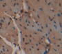 Aspartate Aminotransferase (Ast) Polyclonal Antibody, Cat#CAU26352