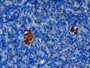 DAB staining on IHC-P;&lt;br/&gt;Samples: Human Pancreas Tissue; &lt;br/&gt;Primary Ab: 10µg/ml Rabbit Anti-Human CHGA Antibody&lt;br/&gt;Second Ab: 2µg/mL HRP-Linked Caprine Anti-Rabbit IgG Polyclonal Antibody&lt;br/&gt;