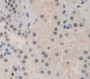 Retinoblastoma Protein 1 (Rb1) Polyclonal Antibody, Cat#CAU26359