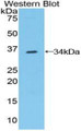 Western Blot; Sample: Recombinant protein.