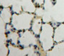 Used in DAB staining on fromalin fixed paraffin-embedded Lung tissue