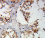 Used in DAB staining on fromalin fixed paraffin-embedded testis tissue