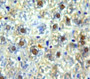 Used in DAB staining on fromalin fixed paraffin-embedded Liver tissue