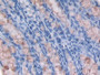 DAB staining on IHC-P; Samples: Mouse Colon Tissue; Primary Ab: 30µg/ml Rabbit Anti-Mouse GMFg Antibody Second Ab: 2µg/mL HRP-Linked Caprine Anti-Rabbit IgG Polyclonal Antibody