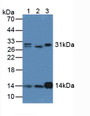 Western Blot; Sample: Lane1: Human Lung Tissue; Lane2: Human Liver Tissue; Lane3: Rat Kidney Tissue.