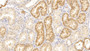 DAB staining on IHC-P; Samples: Human Kidney Tissue;  Primary Ab: 30µg/ml Rabbit Anti-Human LZM Antibody Second Ab: 2µg/mL HRP-Linked Caprine Anti-Rabbit IgG Polyclonal Antibody 