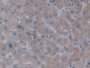 DAB staining on IHC-P; Samples: Human Liver Tissue;  Primary Ab: 10µg/ml Rabbit Anti-Human ASGR1 Ant