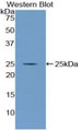 Western Blot; Sample: Recombinant protein.