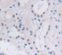 Nucleoporin 188Kda (Nup188) Polyclonal Antibody, Cat#CAU26406