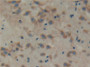 DAB staining on IHC-P; Samples: Mouse Brain Tissue