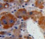 Used in DAB staining on fromalin fixed paraffin-embedded Liver tissue