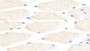 DAB staining on IHC-P; Samples: Mouse Skeletal muscle Tissue;  Primary Ab: 20μg/ml Rabbit Anti-Mouse IL31 Antibody Second Ab: 2µg/mL HRP-Linked Caprine Anti-Rabbit IgG Polyclonal Antibody 