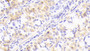 DAB staining on IHC-P; Samples: Human Stomach Tissue;  Primary Ab: 20μg/ml Rabbit Anti-Human NUP205 Antibody Second Ab: 2µg/mL HRP-Linked Caprine Anti-Rabbit IgG Polyclonal Antibody 