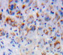 Used in DAB staining on fromalin fixed paraffin-embedded Liver tissue