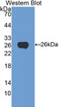 Western Blot; Sample: Recombinant protein.
