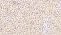 DAB staining on IHC-P; Samples: Rat Liver Tissue;  Primary Ab: 20μg/ml Rabbit Anti-Rat TFR Antibody Second Ab: 2µg/mL HRP-Linked Caprine Anti-Rabbit IgG Polyclonal Antibody 