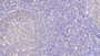 DAB staining on IHC-P; Samples: Porcine Lymph node Tissue; Primary Ab: 20μg/ml Rabbit Anti-Porcine TFR Antibody Second Ab: 2µg/mL HRP-Linked Caprine Anti-Rabbit IgG Polyclonal Antibody