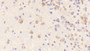 DAB staining on IHC-P; Samples: Mouse Cerebrum Tissue; Primary Ab: 20μg/ml Rabbit Anti-Mouse TFR Antibody Second Ab: 2µg/mL HRP-Linked Caprine Anti-Rabbit IgG Polyclonal Antibody